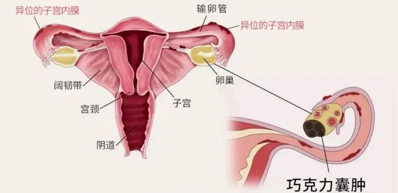 子宫内膜位置图片图片