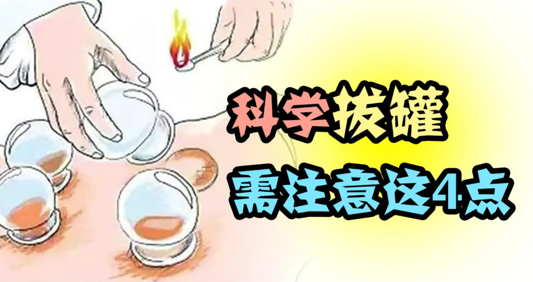 抹完身体乳能拔罐么(抹完身体乳能拔罐么女生)