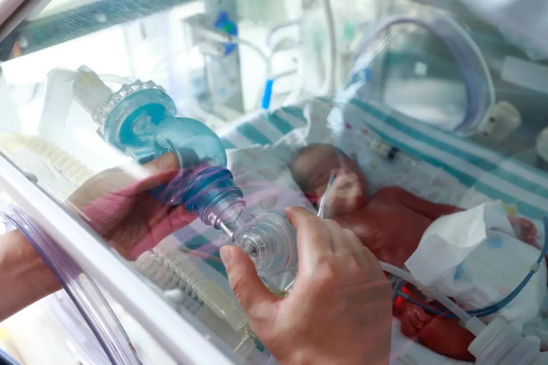 出院了早产迷你三胞胎闯关成功出生时平均体重仅1千克