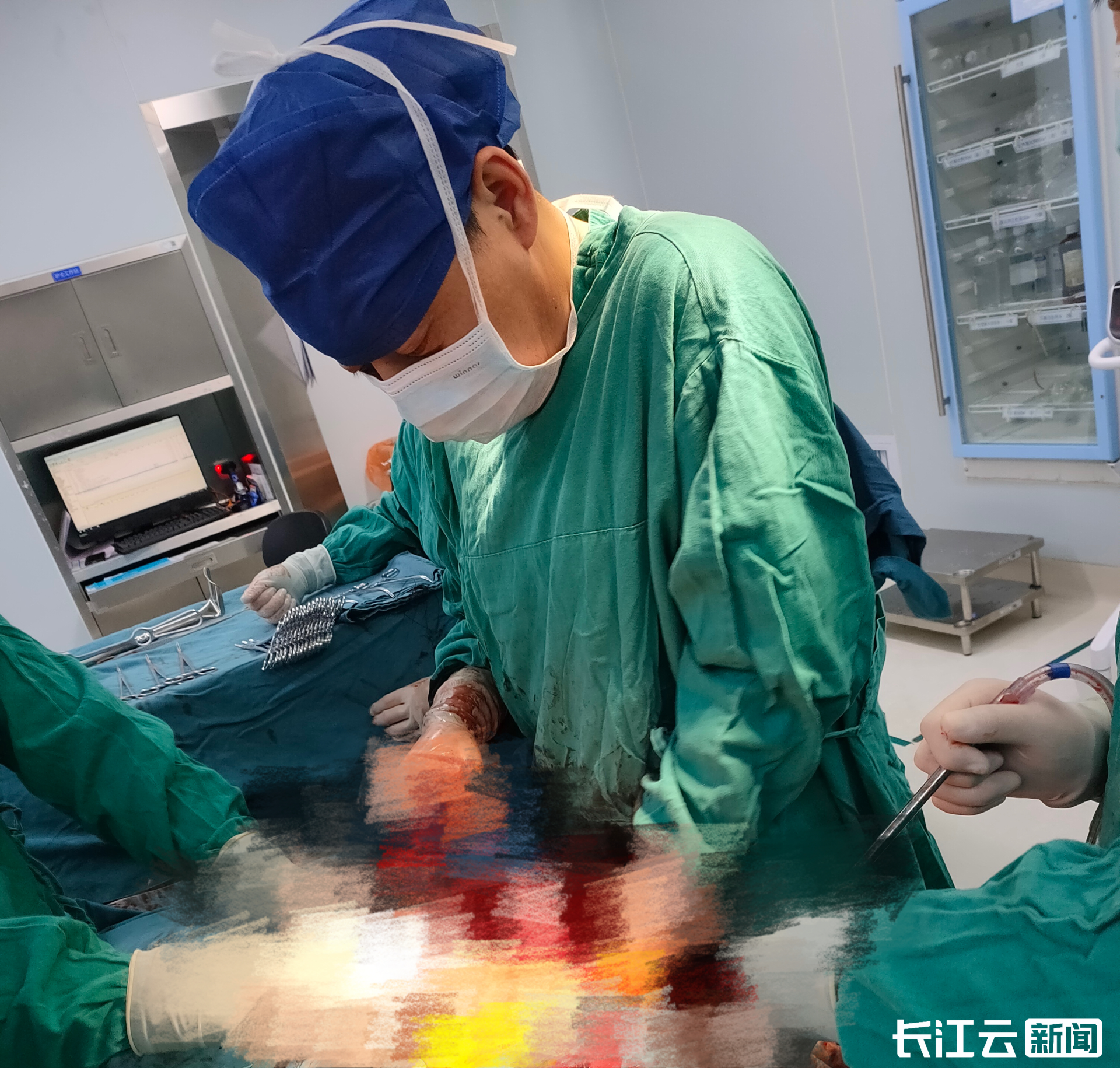 巨大错构瘤裹住肾脏泰康同济泌尿外科成功拆弹
