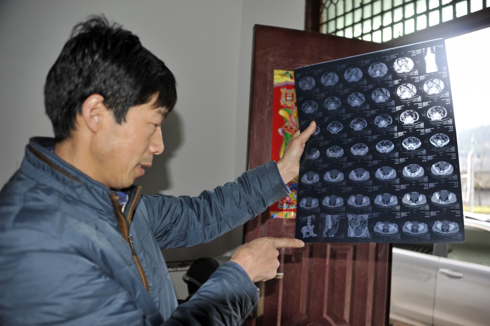 李道文：舍身救火 身负重伤 无怨无悔