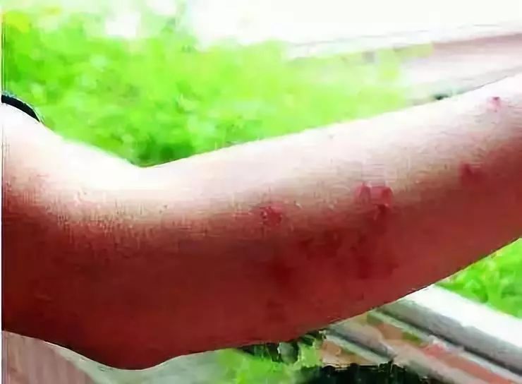 警惕路边碰到这种小土堆赶紧躲远点已有多人中招