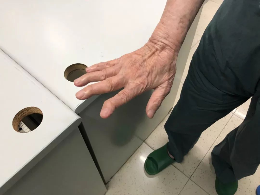 吃饭食指指尖微微向内侧弯吴孟超的右手明显变形由于常年手术正在进行