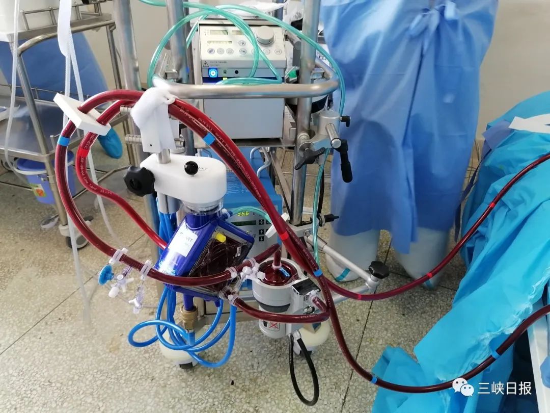 宜昌首次启用ecmo技术救治重症患者