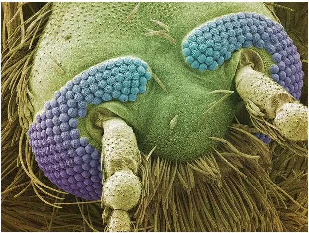 显微镜下的舌头图片