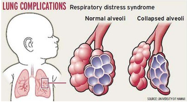 早产儿最早可以有多早
