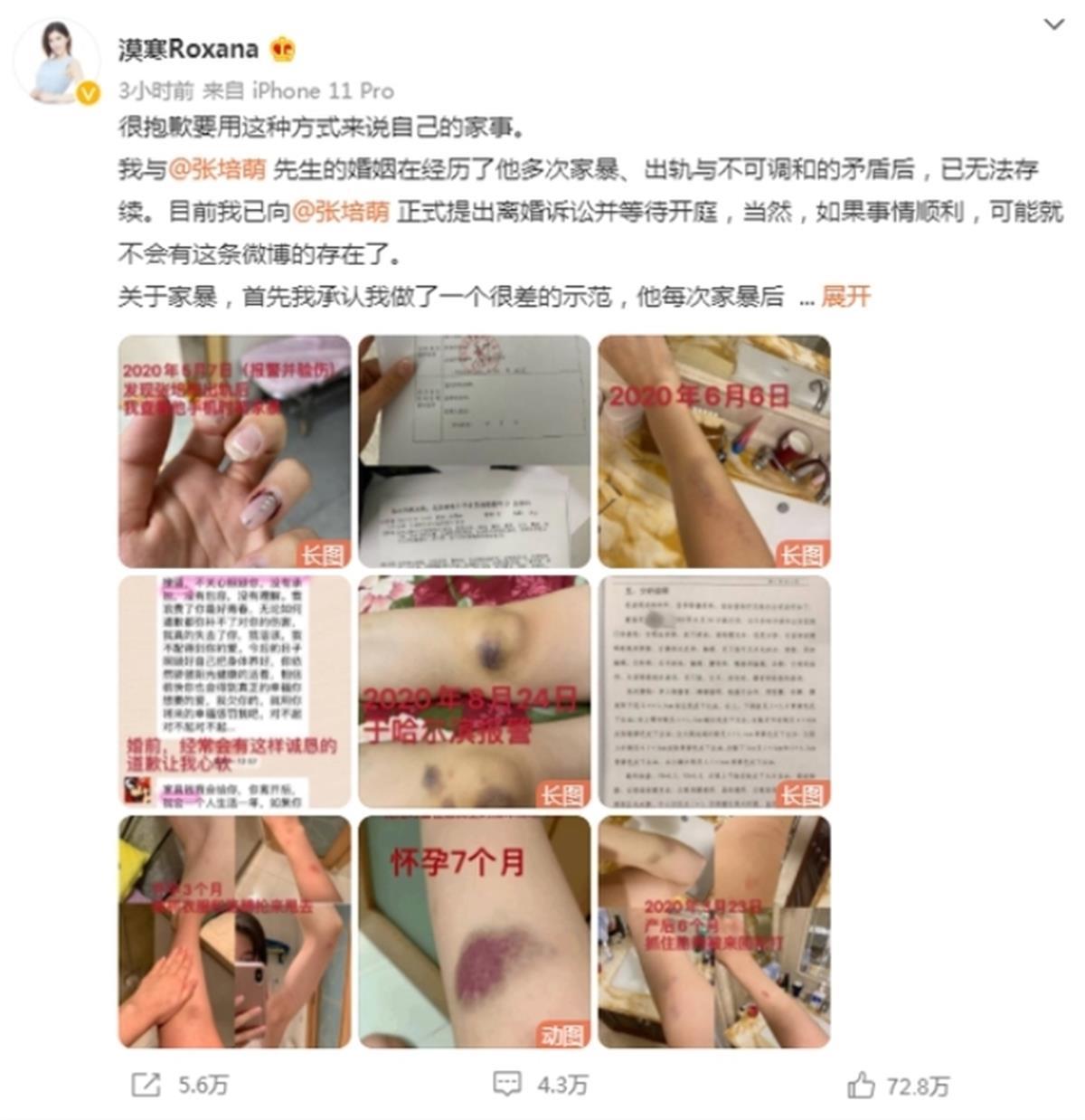 短跑名将张培萌殴打岳母被行拘,曾被妻子控诉家暴,现任清华大学助教