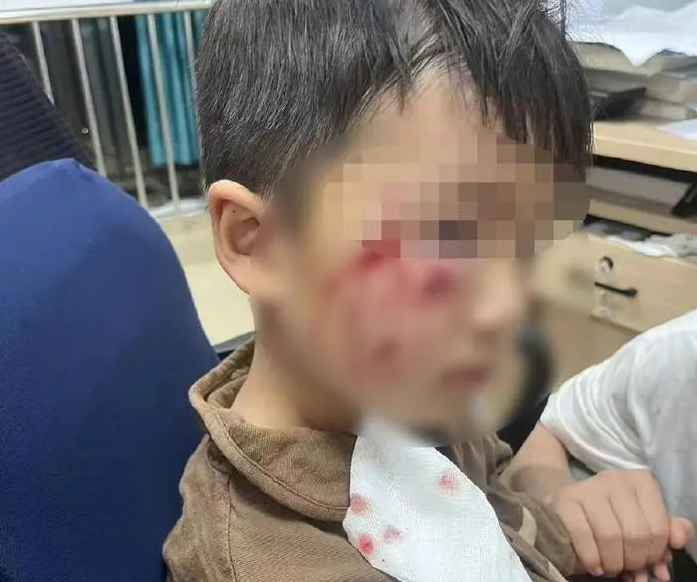  3岁男童被恶犬咬伤离世，其母发声