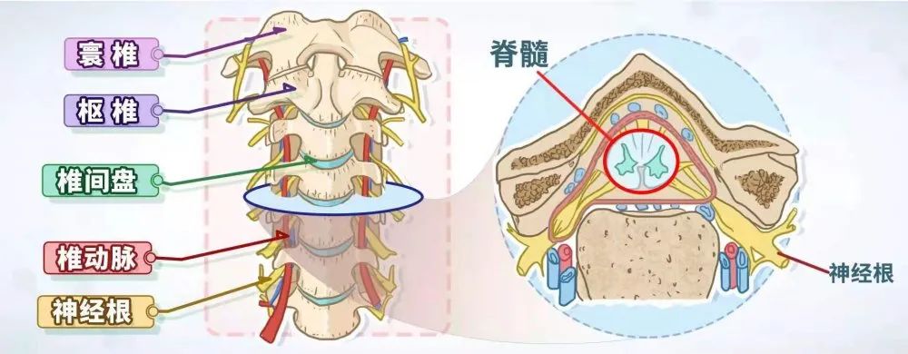 颈椎病常找上门这个坏习惯你可能天天在做试试这4组动作还有救