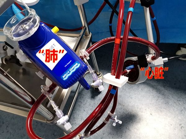 市中医院顺利开展首例体外膜肺氧合ecmo术