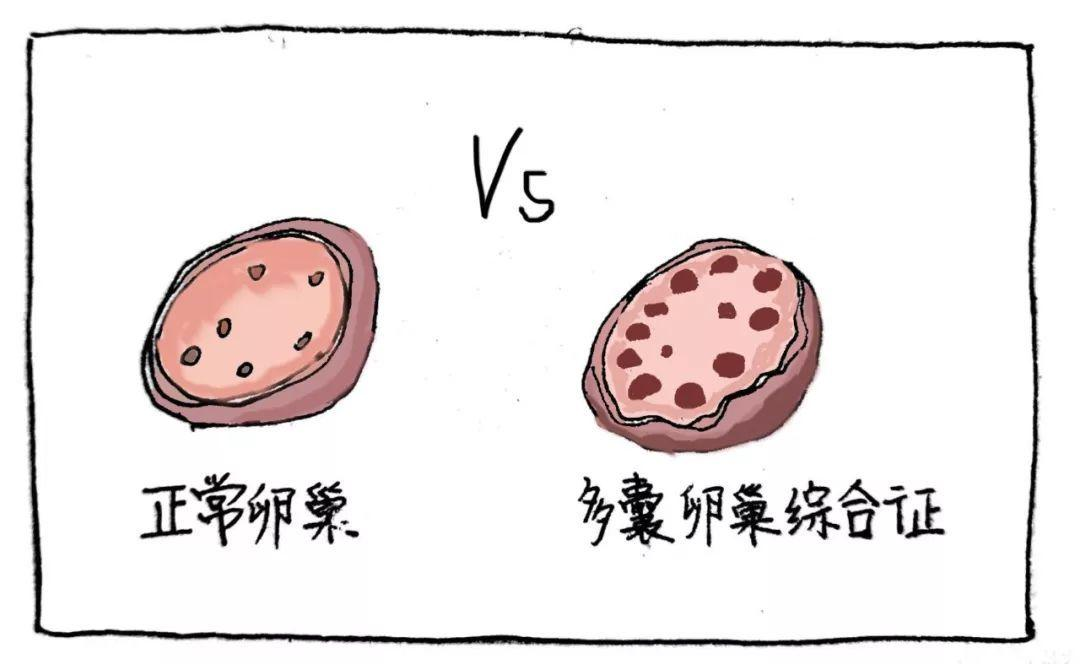 卵巢功能晴雨表生育能力金標準關於amh檢查聽聽專家怎麼說