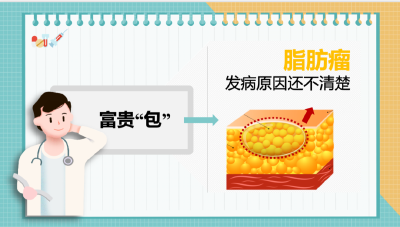 去正規醫院諮詢專業的醫生,四肢軀幹軟組織裡的脂肪瘤可以找骨科醫生