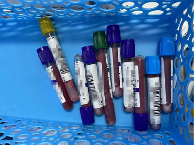 武汉一女子“阳过”后疯狂进补 ，血脂“爆表”超正常近80倍