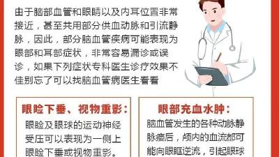 注意了！身体出现这些不起眼的症状，可能是脑血管出问题了！