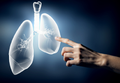 死亡率高达40%！“白肺”竟和这8种情况都有关？告诉你真相