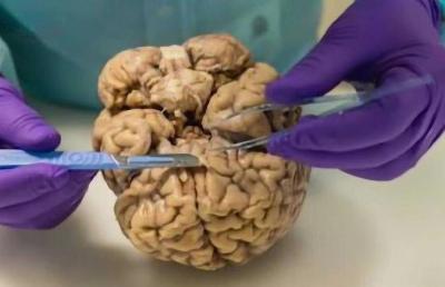 “死亡”50分钟猪脑，被中国科学家成功“复活”