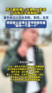 男子嚼槟榔15年患口腔癌舌头被割掉大半