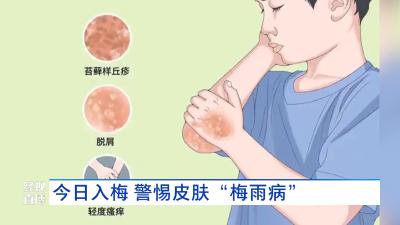 今日入梅  警惕皮肤“梅雨病”