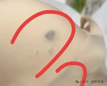 知名品牌内衣里惊现虫子？品牌方：出厂质检不可能检查不出，疑似同行恶意搞事！市监局回应
