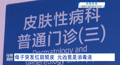 母子突发红斑蜕皮 元凶竟是消毒液