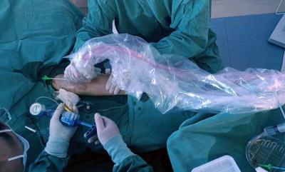 房县人民医院新技术助力血液透析患者