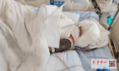 1岁女童重度烫伤昏迷不醒 十堰人医专家通力合作让其重获新生