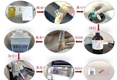 精准诊断再添利器—房县人民医院病理科成功开展细胞蜡块技术