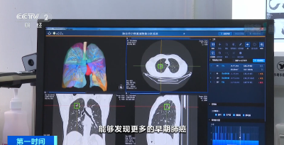 早期大多无症状！我国恶性肿瘤发病率首位，是它→