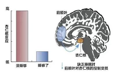 你认为正常的几种表现，却是严重缺觉！ 