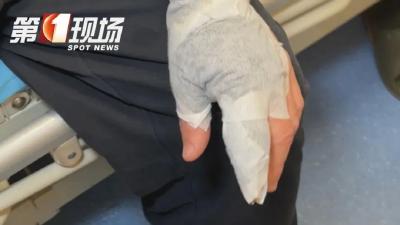 戴手套！已经有人不慎感染，这几点一定要注意→
