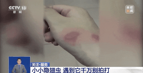 当心毁容！遇到这种虫子千万别打！