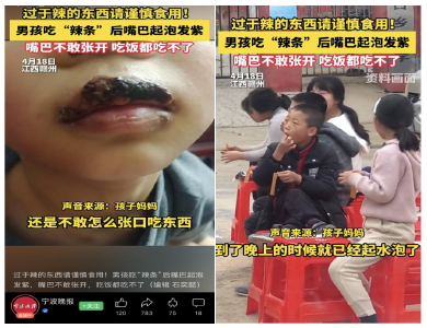 5毛辣条“威力”大！一男孩口腔遭受重创...