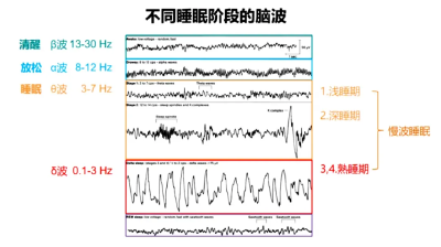 就算实在睡不着，也建议你先把眼睛闭上