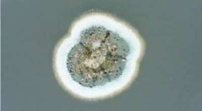 扔了可惜吃了害怕 水果烂了一小块到底还能不能吃？