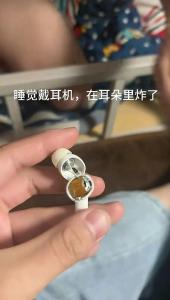 大学生回应“睡觉时蓝牙耳机突然在耳内爆炸”