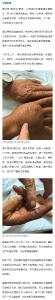 广西横州已有女子被蛇咬伤离世，约800条至900条蛇因洪水出逃