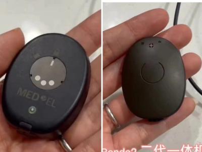 人工耳蜗外机不慎丢失 三岁半女童生活受影响 　