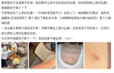 烫伤后千万不能涂牙膏！正确的5个步骤是…… 