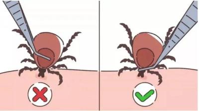 @麻城人：见招拆招不要慌 对付蜱虫听我讲