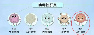 一盘下肚，男子急性肝衰竭！这道菜很多人都爱吃......
