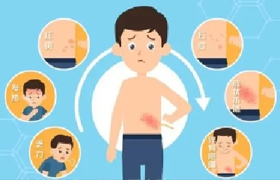 痛到“怀疑人生”！这种病进入高发期