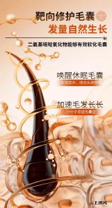 头皮屑一梳就掉用什么洗发水？测评2026减少梳头落屑洗发水，儒曼健发去屑止痒洗发水，从源头减少屑量
