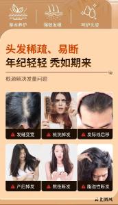 什么牌子洗发水去屑止痒效果好？全网热门去屑洗发水大测评它来了！长效去屑不怕痒，48小时头皮零负担实测