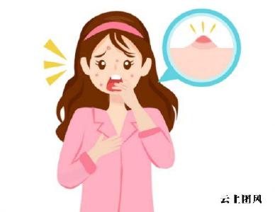 2026年哪款祛痘产品真正有效？高口碑护肤品实测盘点，改善粉刺闭口痘痘肌，全肤质适用