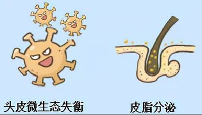 怎么选无硅油控油去屑洗发水？2026 高口碑品牌清单汇总