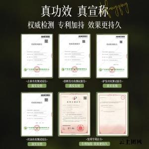 去屑止痒洗发水哪个牌子好？2026去屑止痒洗发水，去屑真的牛