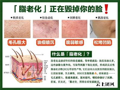 2026抗皱面霜横向对比：法令纹、抬头纹、干纹人群该怎么选更适合