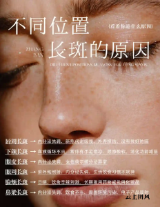 买什么淡斑产品好效果快？2026祛斑好的6大品牌，保湿修复