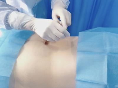 县妇幼保健院：中医助力 实现个性化健康减脂