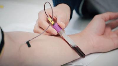 这6类人天生容易长血栓，4个血栓的“报警信号”要重视！